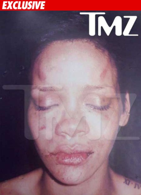 rihanna pictures after beating tmz. Rihanna#39;s photo from TMZ